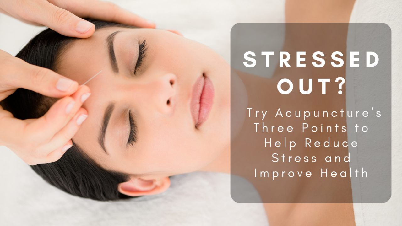 Stressed Out? Try Acupuncture’s Three Points to Help Reduce Stress and